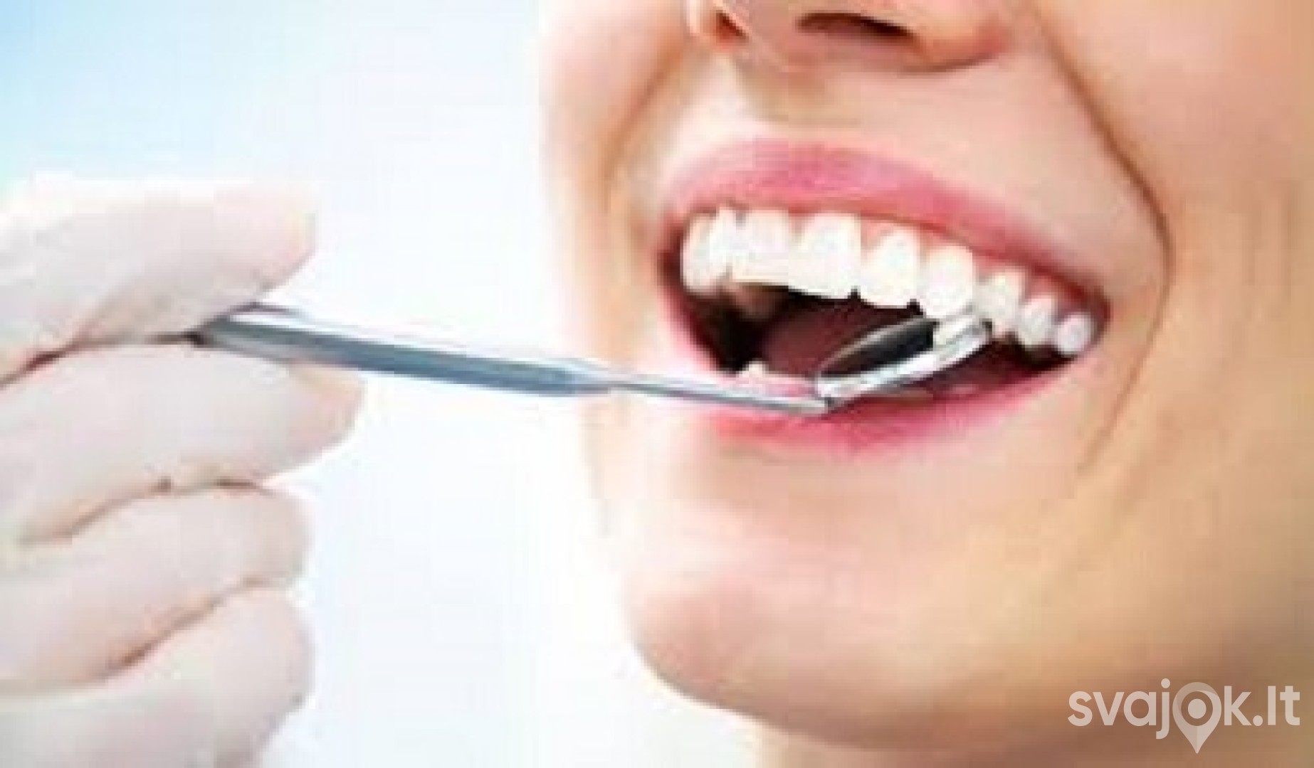 Ofisinis dantų balinimas + DOVANA (burnos higiena) 2