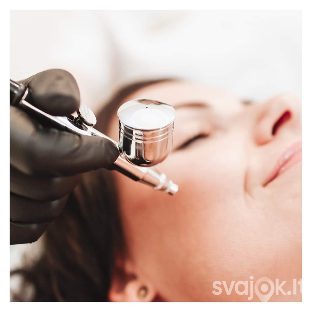 Neinvazinė veido biorevitalizacija su deguonimi 2